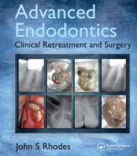 Advanced Endodontics