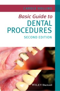 Basic Guide to Dental Procedures