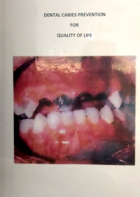 Dental caries prevention for quality of life