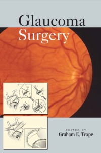 Glaucoma Surgery