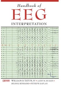 Handbook of EEG INTERPRETATION