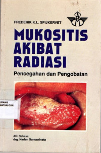 Mukositis Akibat Radiasi : Pencegahan dan pengobatan