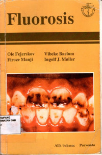 Fluorosis = Dental fluorosis