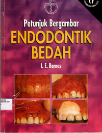 Petunjuk bergambar endodontik bedah = Surgical endodontics : colour manual