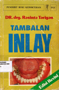 Tambalan inlay