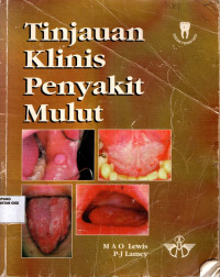 Tinjauan klinis penyakit mulut = Clinical Oral medicine