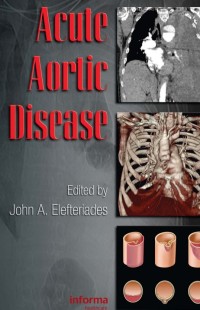 Acute Aortic Disease