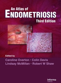 An Atlas of ENDOMETRIOSIS