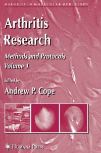 Arthritis Research