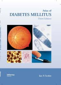 Atlas of Diabetes Mellitus