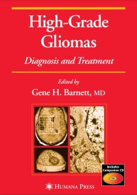 High-Grade Gliomas Diagnosis and Treatment