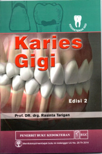 Karies gigi