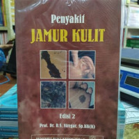 Penyakit Jamur Kulit