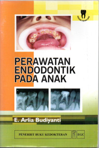 Perawatan endodontik pada anak